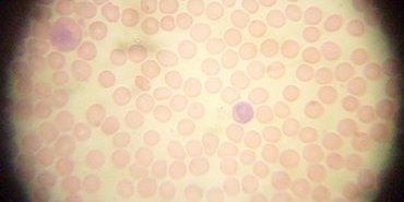 frottis sanguin leucocytes