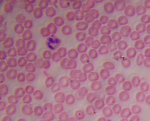 L'observation des cellules sanguines au microscope